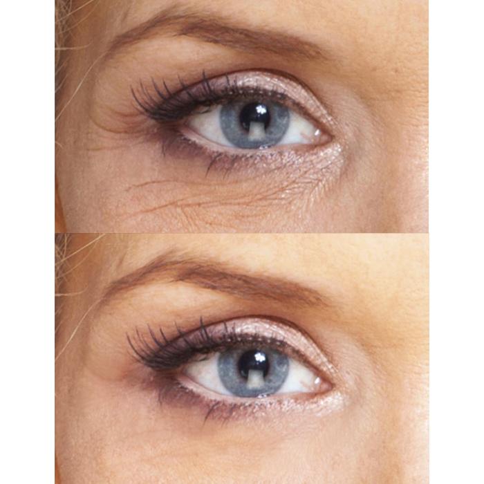eye wrinkle cream for sensitive skin